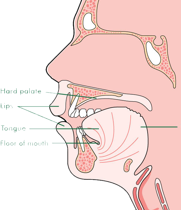 Mouth cancer pic.png
